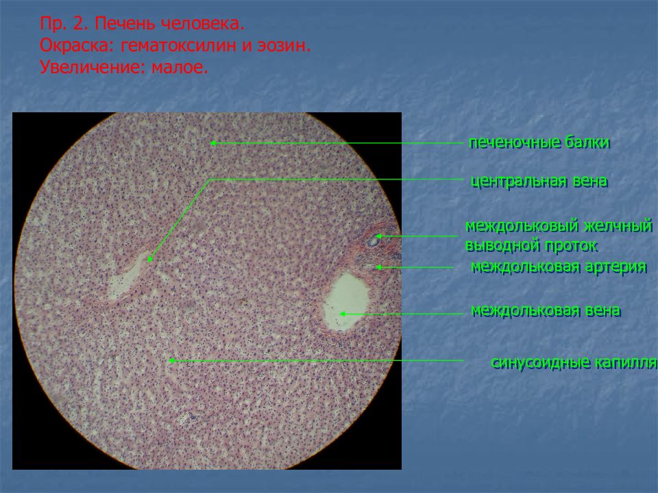 Малое увеличение. Печень человека окраска гематоксилин-эозином. Препарат печень человека гематоксилин эозин. Препарат «печень человека»окраска гематоксилином и эозином. Печень окраска гематоксилин и эозин препарат.