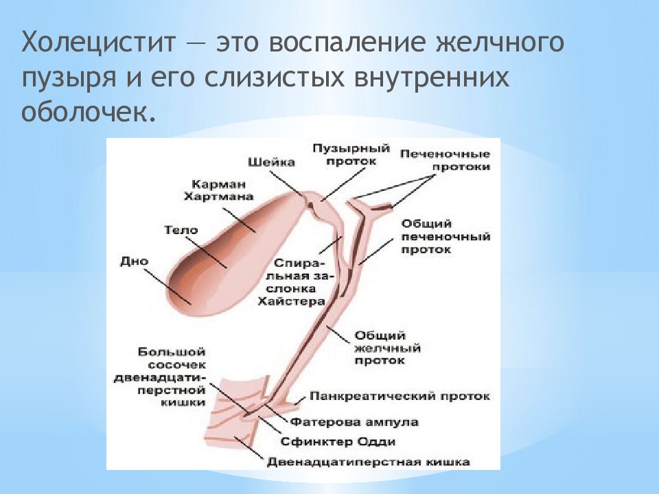 Холецистит что это. Холецистит воспаление. Воспаление желчного пузыря. Холецистит желчного пузыря.