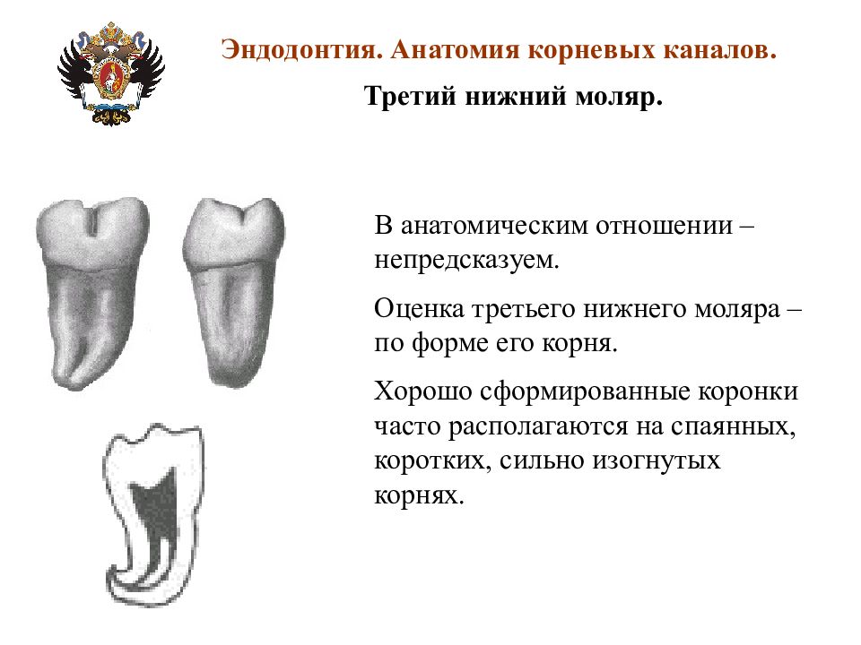 Анатомия каналов. Анатомия корневых каналов нижних моляров нижней. Второй моляр нижней челюсти анатомия корневых каналов. Третий Нижний моляр анатомия. 1 Моляр нижней челюсти анатомия корневых каналов.