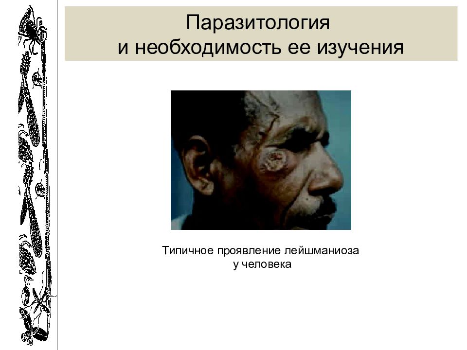 Лейшманиоз природно очаговое. Лейшманиоз на коже человека.