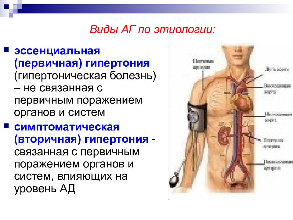 Симптоматическая артериальная гипертензия презентация