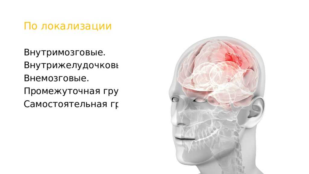 Эпендимальные опухоли. Эмбриональная опухоль ЦНС. Внутри мозговые и внемохговые опухоли.