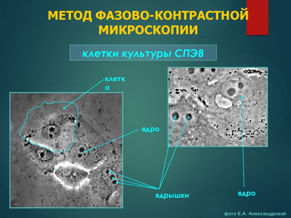 Фазово контрастная микроскопия. Фазово-контрастная микроскопия принцип метода. Фазово-контрастная микроскопия клетка. Фриц Цернике фазово контрастный микроскопия. Микроскопия (световая, фазово-контрастная, люминесцентная.