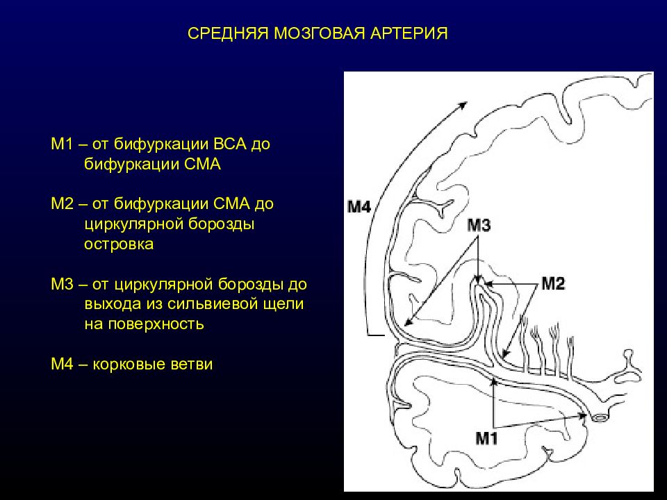 Гипоплазия сегмента а1 передней мозговой артерии. Сегменты ВСА на кт. Сегменты средней мозговой артерии на кт. Сегмент м1 среднемозговой артерии. Сегменты внутренней сонной артерии схема кт.