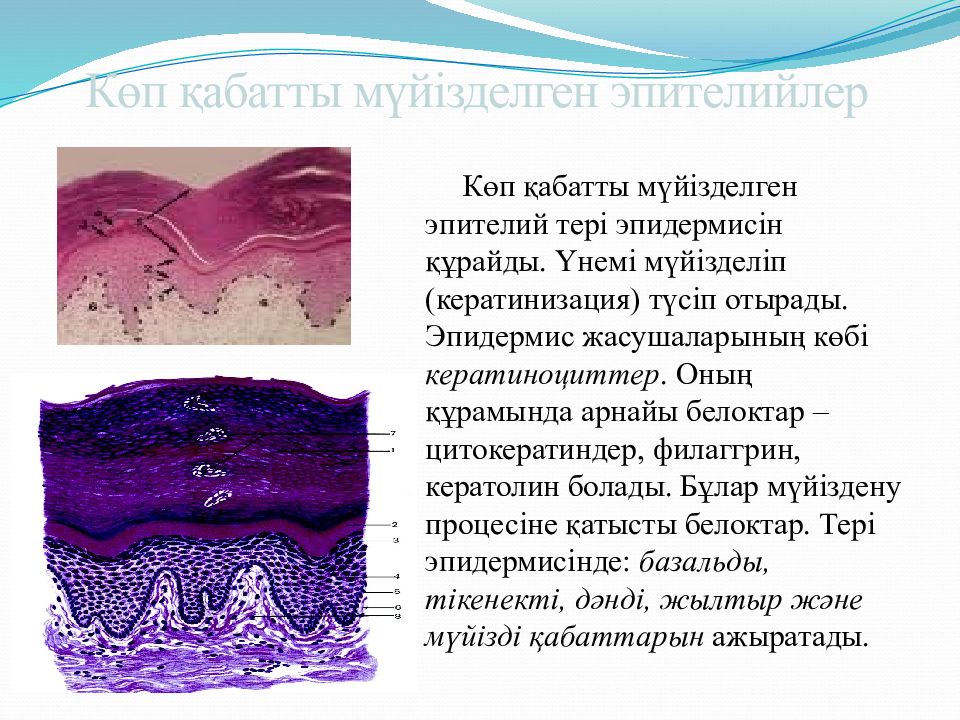 Эпителий плоский повышен. Кератинизация гистология. Кератинизация кожи гистология. Эпителий гистология презентация.