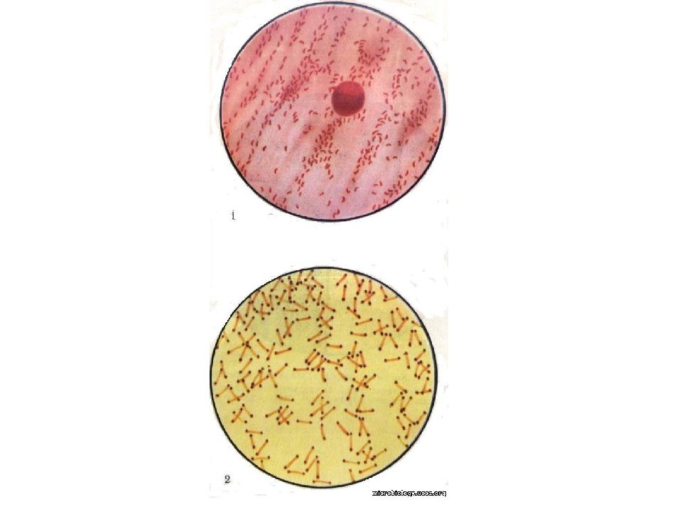 Морфология и физиология бактерий. Морфология и физиология микроорганизмов. Иеремия морфология микробиология.