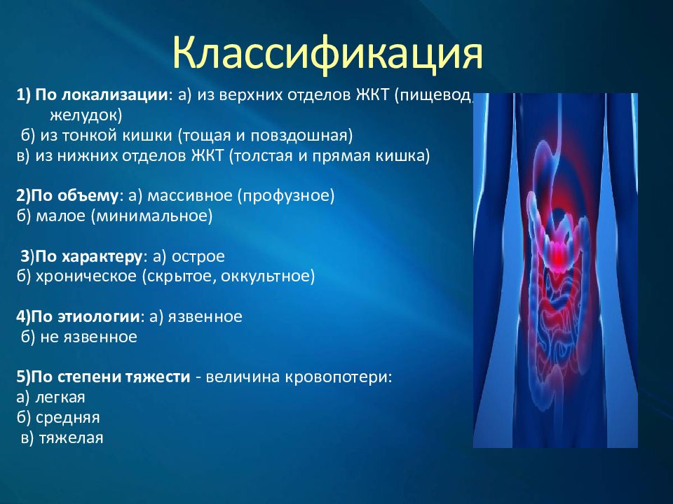 Желудочно-кишечные кровотечения этиология. Классификация желудочных кровотечений.