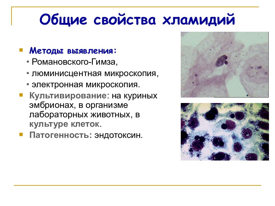 Элементарные тельца хламидий по романовскому гимзе окрашиваются. Хламидии Романовскому Гимзе. Риккетсии микроскопия. Хламидия трахоматис окраска по Романовскому Гимзе. Хламидия трахоматис микроскопия.