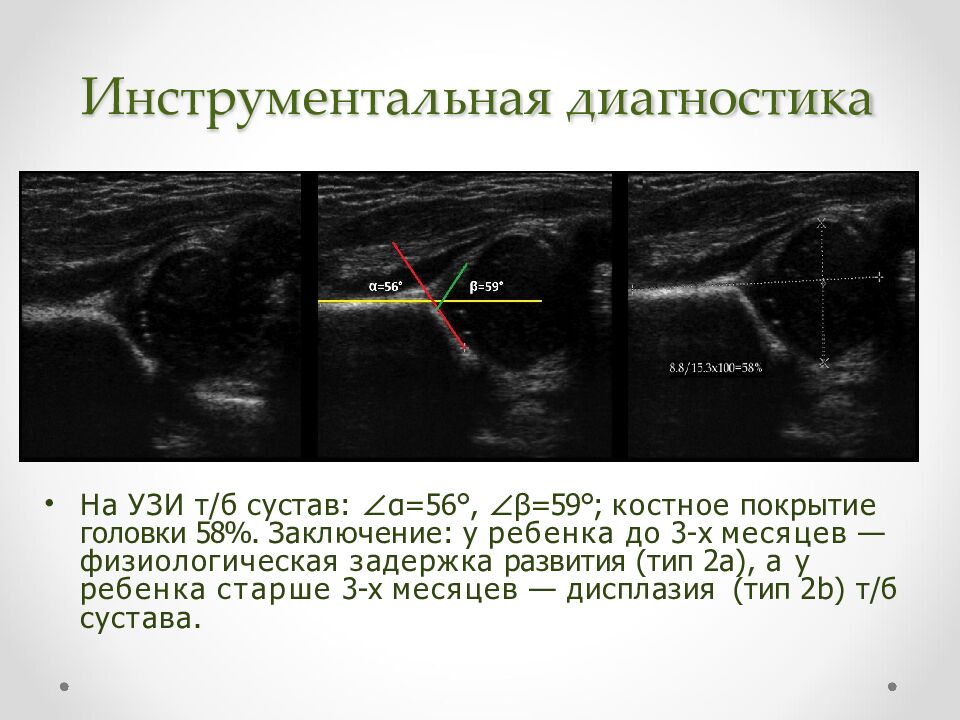 Инструментальная диагностика
