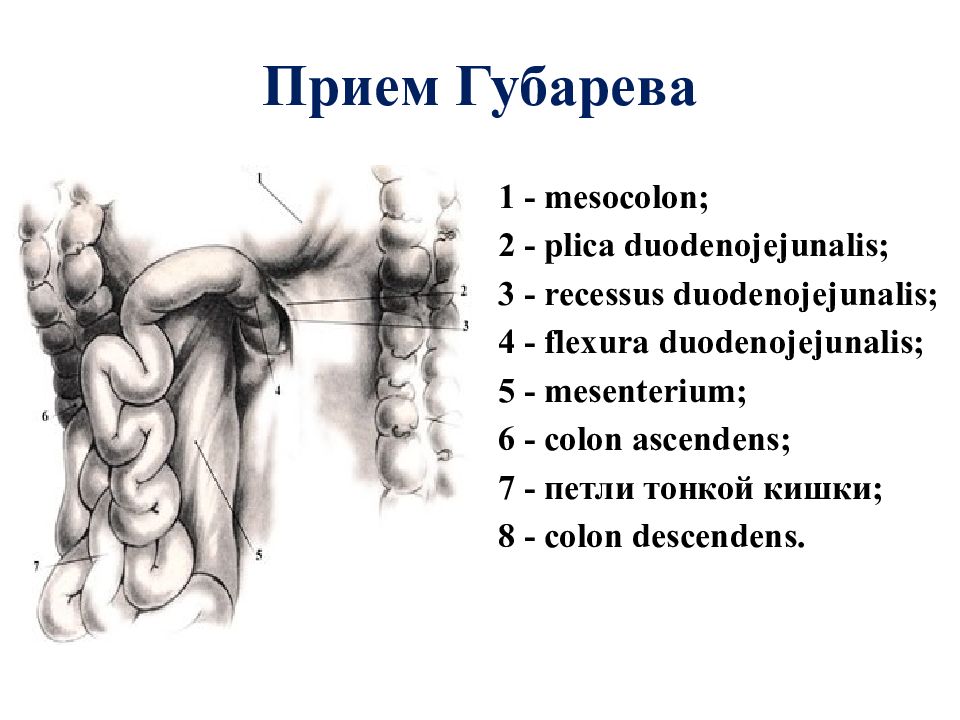 Топографическая анатомия тонкой кишки презентация