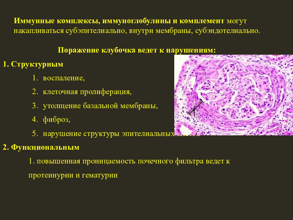 Острый гломерулонефрит презентация