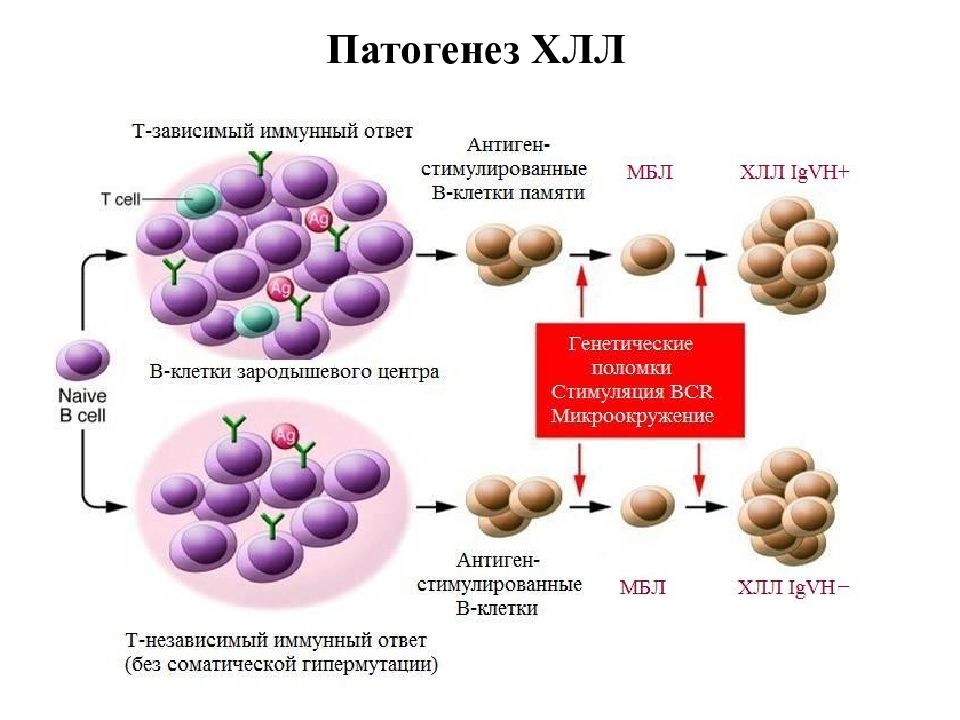 Больным лимфолейкозом