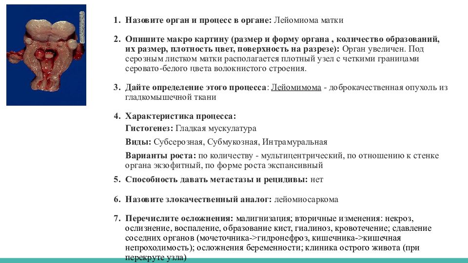 Узнать орган. Органом называют. Лейомиома мочеточника. Коллоквиум по анатомии 1.