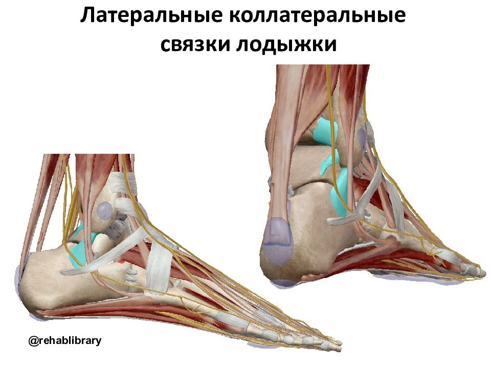 Голеностопные связки. Латеральная лодыжка. Латеральная лодыжка болит. Латеральная.