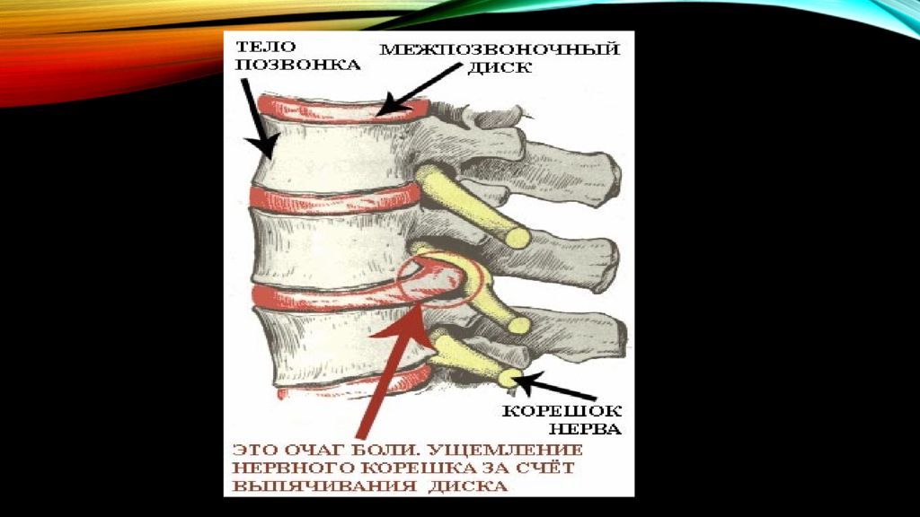 Корешки поясницы