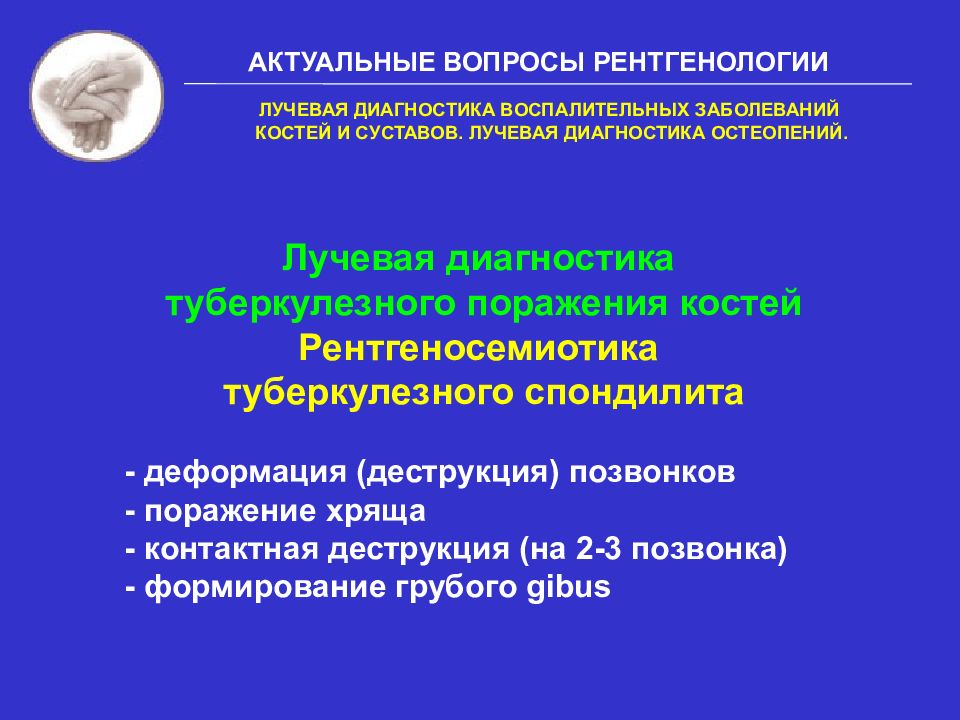 Диагноз кости. Лучевая диагностика воспалительных заболеваний костей. Лучевая диагностика рентгенодиагностика заболеваний костей. Рентгенодиагностика воспалительных заболеваний костей. Заболевания костей рентгенология.