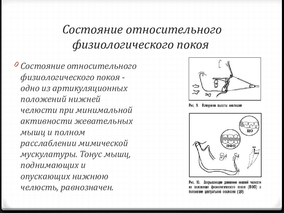 Состояние покоя аккомодации фокус на сетчатке рисунок