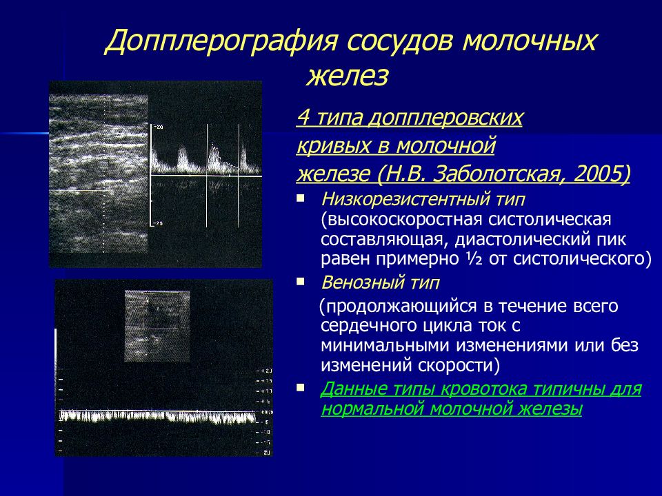 Железистый тип строения молочных желез