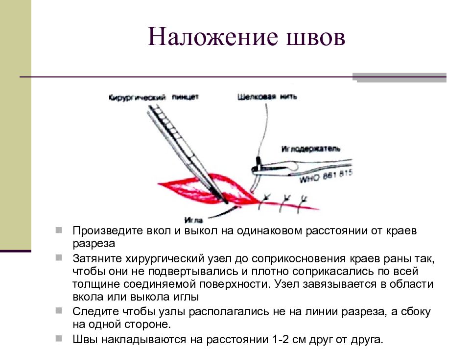 Схема хирургических швов