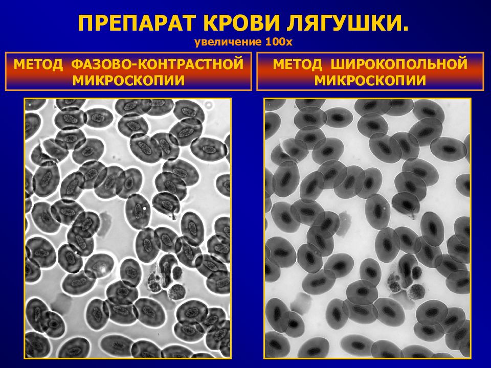 Увеличение 100. Фазово-контрастная микроскопия дрожжи. Метод фазового контраста в микроскопии препараты. Фазовый контраст микроскопия. Фазово контрастный микроскоп на препарате.