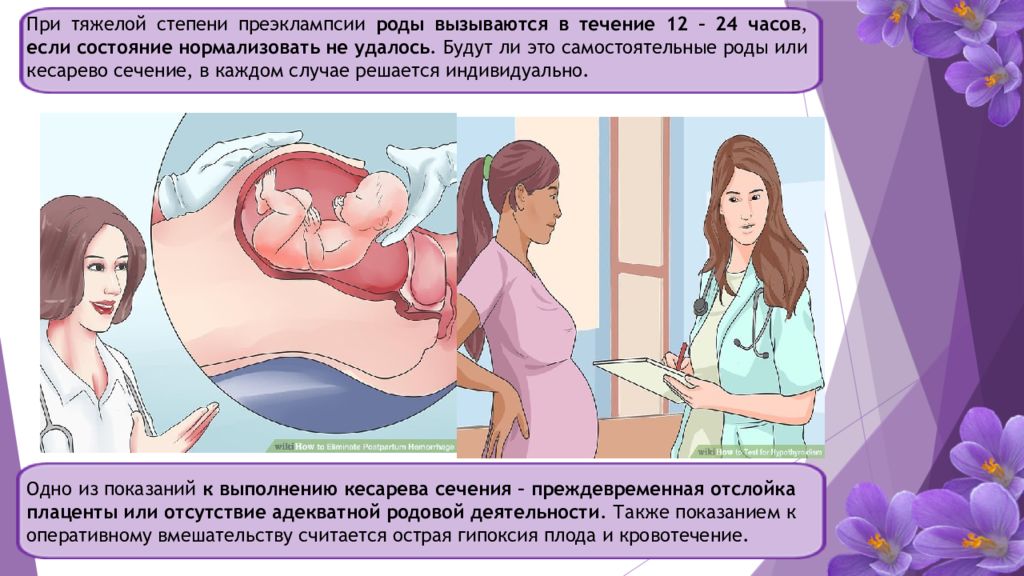 Четвертая беременность роды. Преэклампсия в родах. Эклампсия у беременных презентация. Беременность и преэклампсия. Презентация преэклампсия и эклампсия беременных.