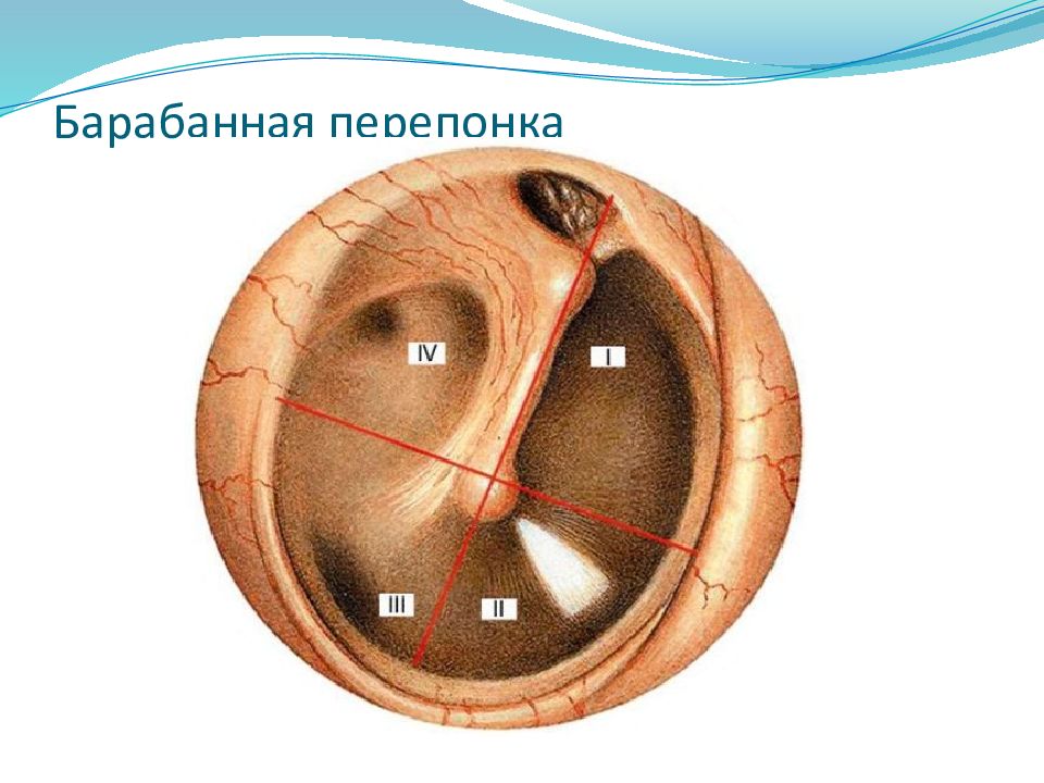 Спайки в ушах. Ретракционный карман барабанной перепонки. Барабанная перепонка отоскопия. Перфорация барабанной перепонки. Квадранты барабанной перепонки.