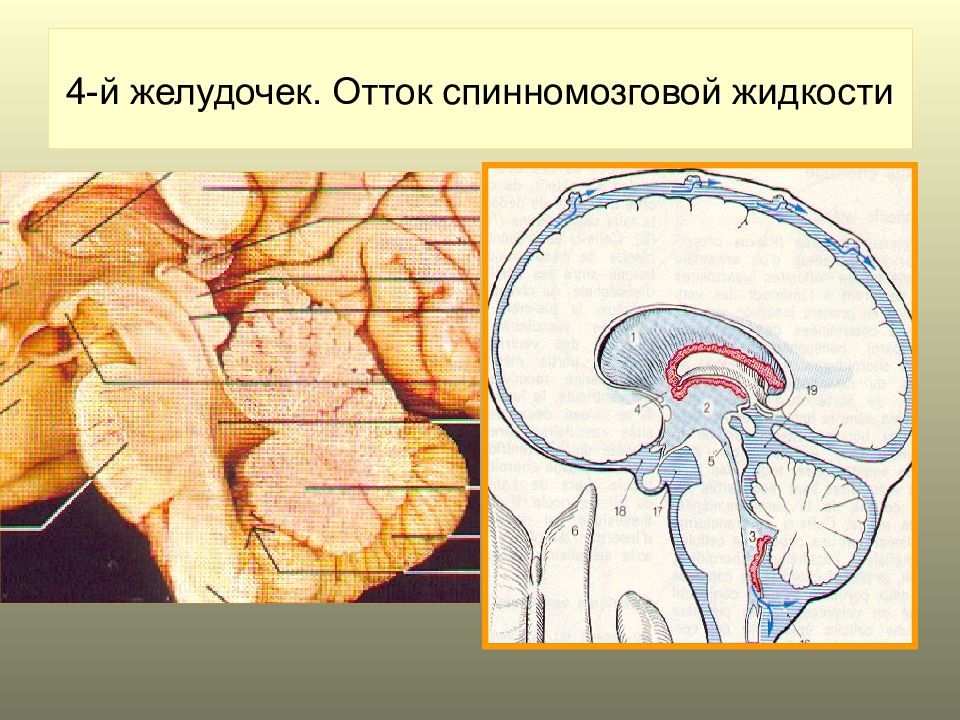 Изолированный желудочек. Схема пути оттока спинномозговой жидкости. Отток из желудочков мозга. Пути оттока спинномозговой жидкости из 4 желудочка. Отверстия Мажанди и Лушки.
