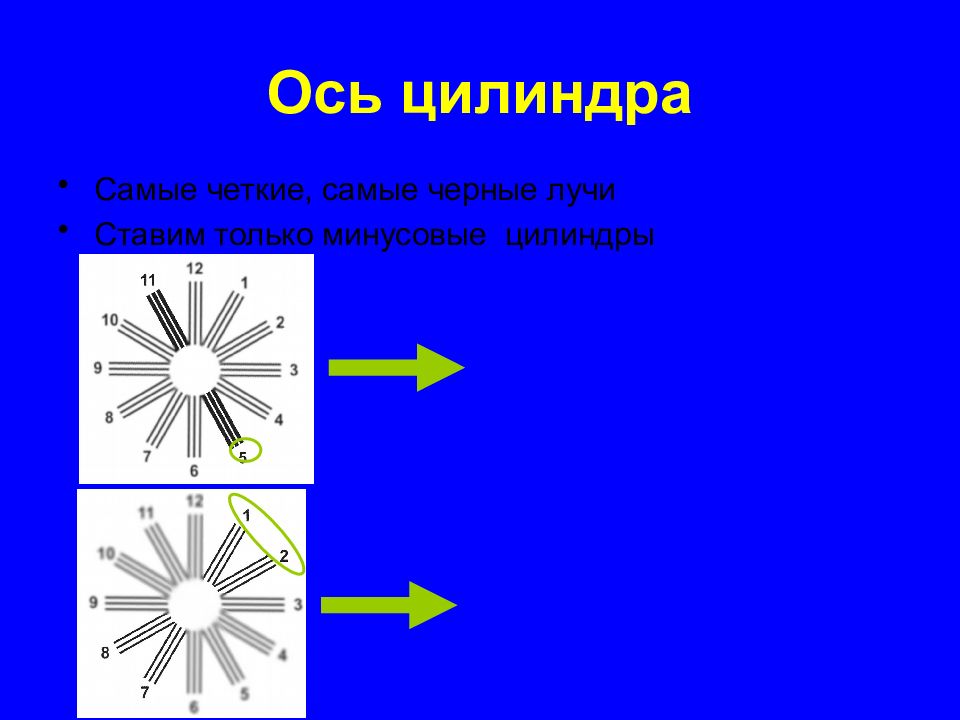 Астигматизм ось цилиндра. Астигматизм ось цилиндра