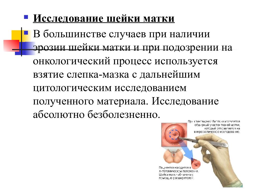 Чего нельзя делать после биопсии шейки матки. Протокол взятия биопсии шейки матки. Биопсия шейки матки оснащение алгоритм.