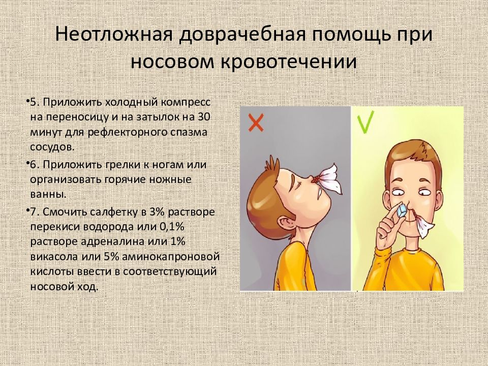 Пошла носом. Принослвом кровотечении. Остановка носового кровотечения алгоритм. При носовом кровотечении. Оказание первой помощи при носовом кровотечении.