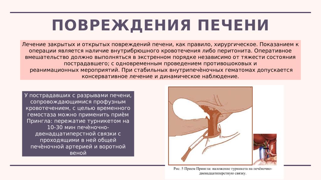 Закрытые травмы презентация