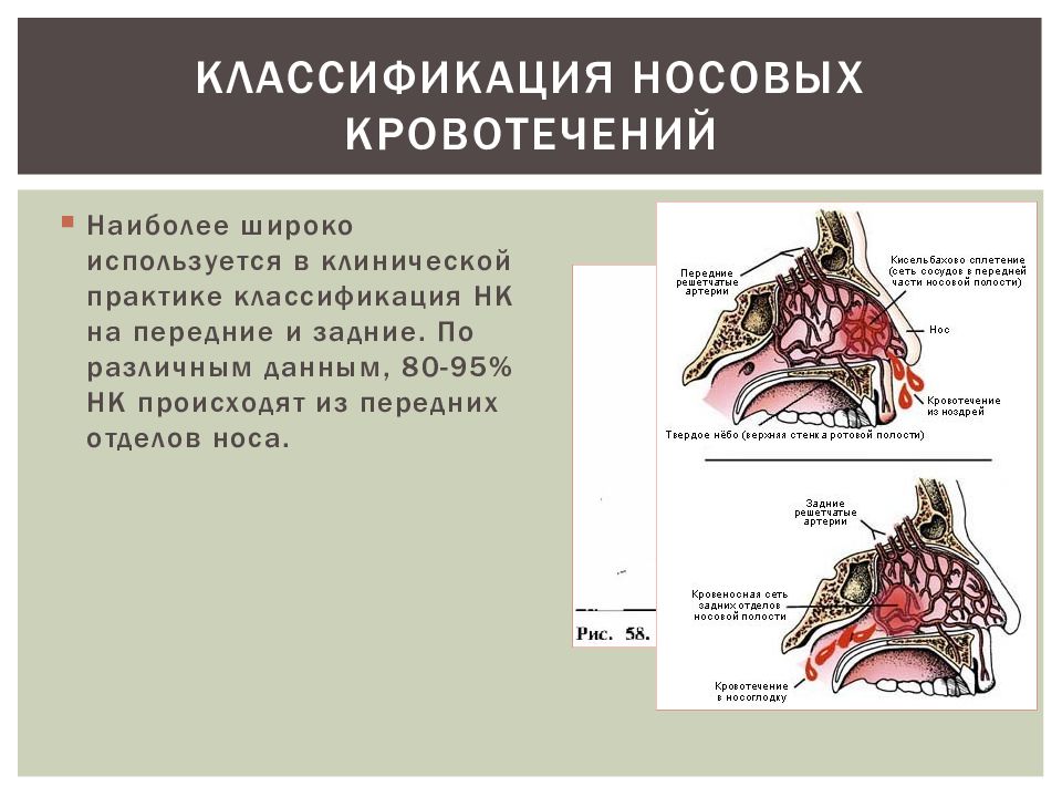 Носовое кровотечение презентация