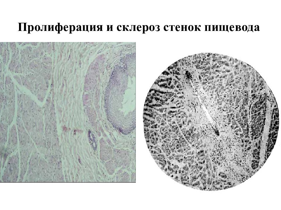 Нарушение кровообращения и лимфообращения патология презентация