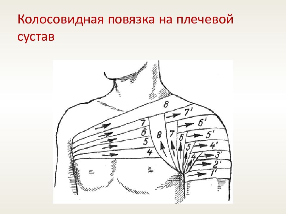 Дезо повязка на плечевой схема