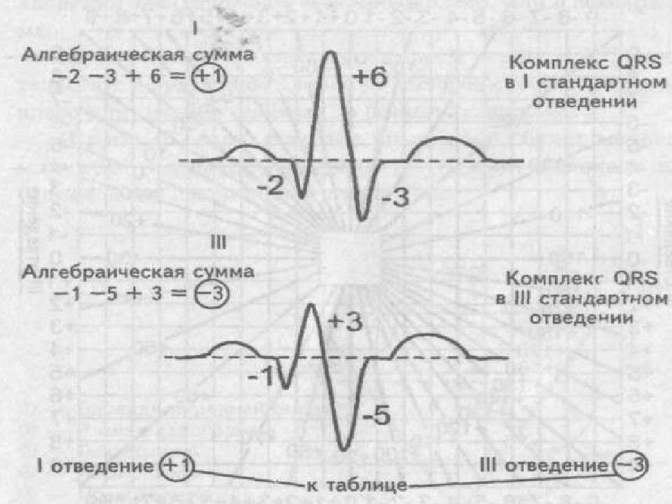 Диаграмма дьеда экг