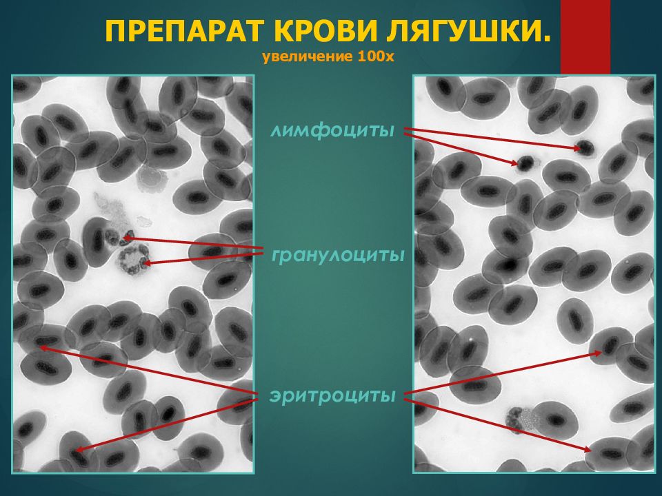 Увеличение 100. Препарат крови лягушки. Мазок крови лягушки препарат. Препарат крови лягушки под микроскопом. Кровь лягушки.