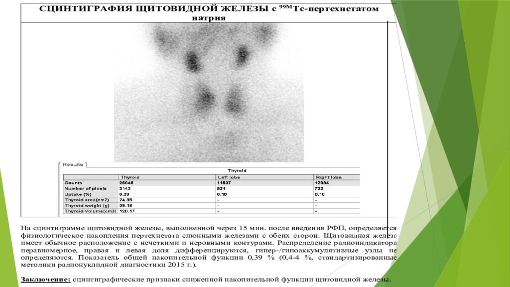 Сцинтиграфия щитовидной железы. Расшифровка сцинтиграфии щитовидной железы. Заключение сцинтиграфии щитовидной железы. Сцинтиграфия щитовидной железы протокол. Направление на сцинтиграфию щитовидной железы.