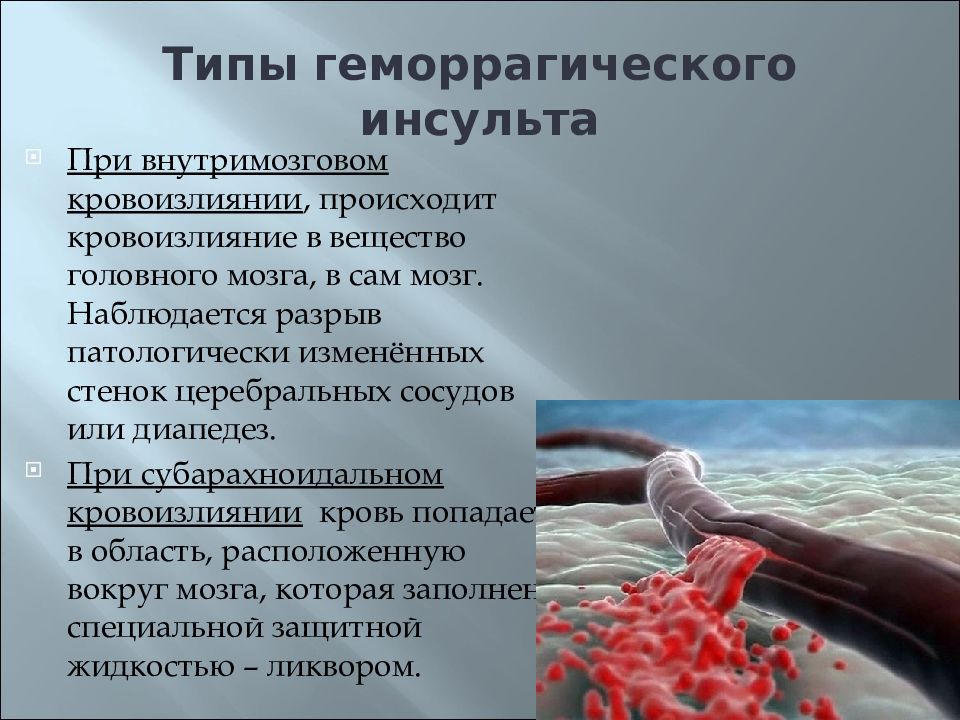 Инсульт головного мозга последствия. ОНМК геморрагический инсульт. Геморрагический инсульт причины. Типы геморрагического инсульта. Геморрагический инсульт по локализации.