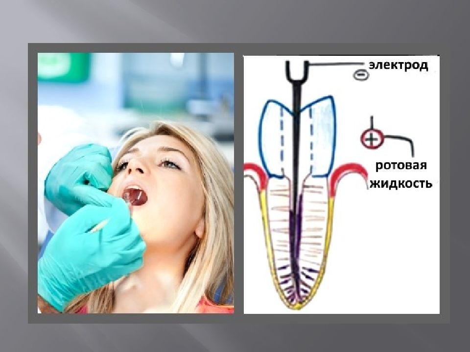 Электрофорез в стоматологии презентация