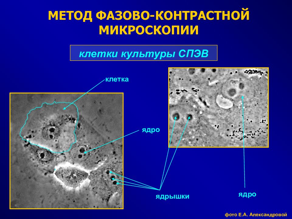 Клетка микроскопия. Фазово-контрастная микроскопия клетка. Микроскопия (световая, фазово-контрастная, люминесцентная. Фазово-контрастная микроскопия гистология. Метод фазово-контрастной микроскопии.