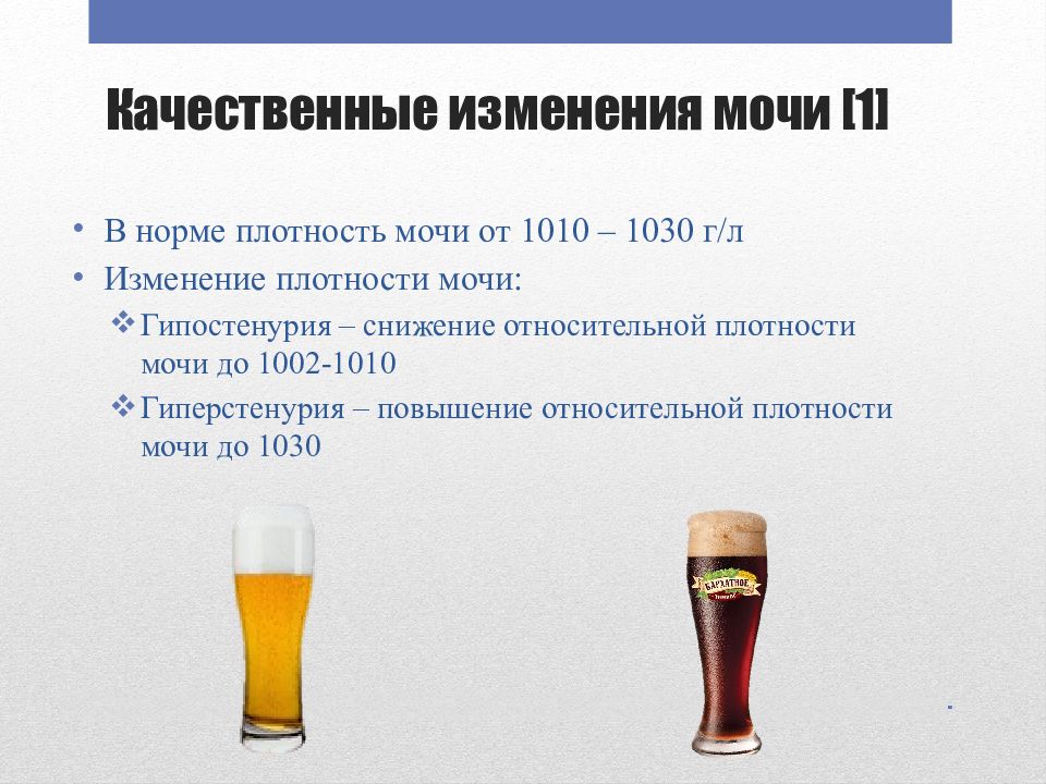 Изменение мочи. Качественные изменения мочи. Изменение плотности мочи.