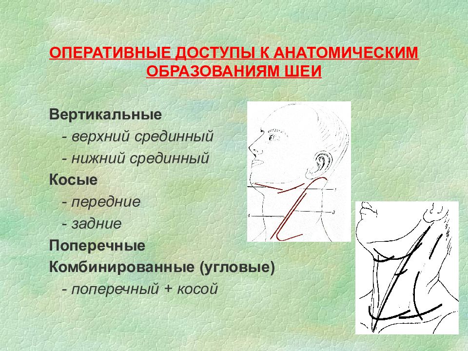 Операции на шее презентация