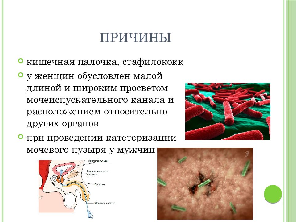 Кишечная палочка у женщин. Кишечная палочка. Кишечная палочка причины. Кишечная палочка стафилококк. Кишечная палочка и цистит.