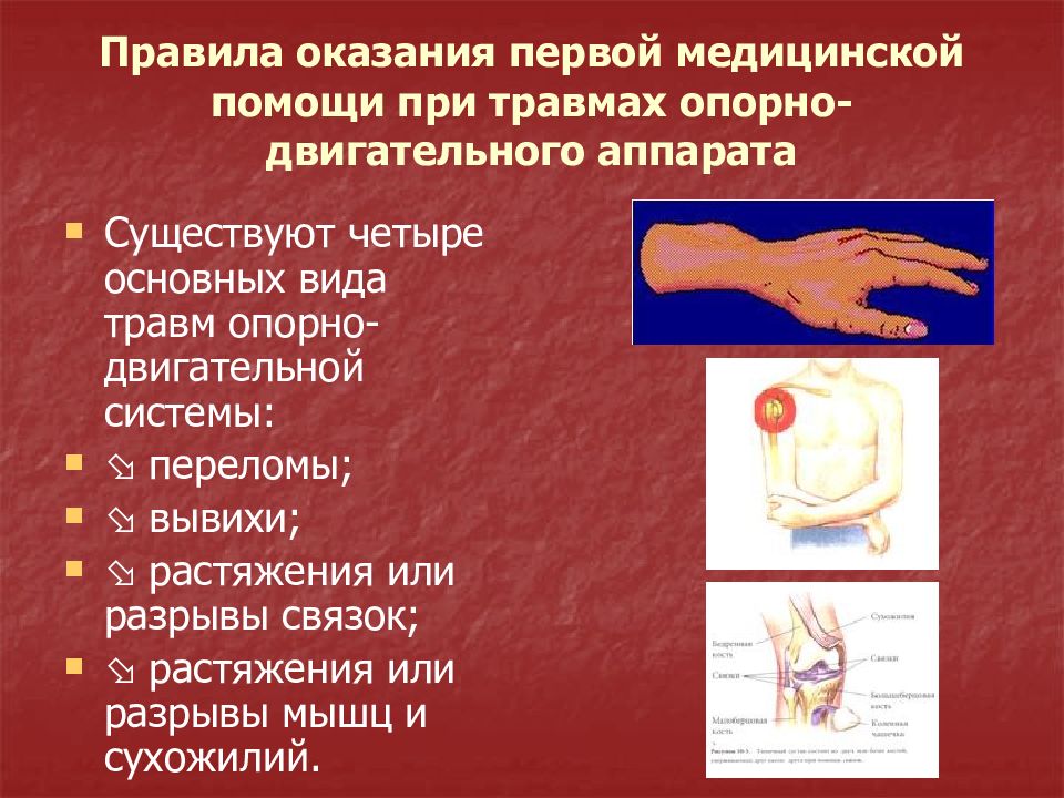 Первая помощь при травмах обж презентация