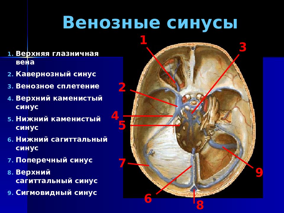 Верхние вены мозга. Анатомия синусов твердой мозговой. Синусы твёрдой мозговой оболочки анатомия. Вены синусы твердой мозговой оболочки. Кавернозный синус оболочки мозга.