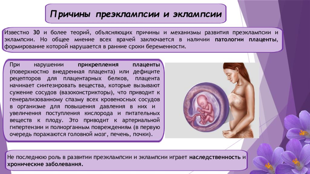 Преэклампсия беременных презентация