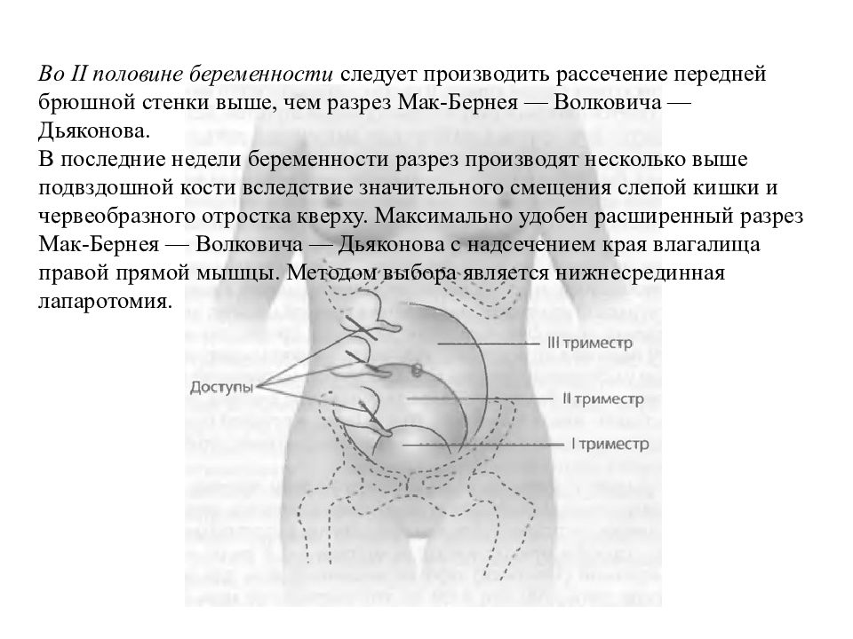 Беременность и аппендицит презентация