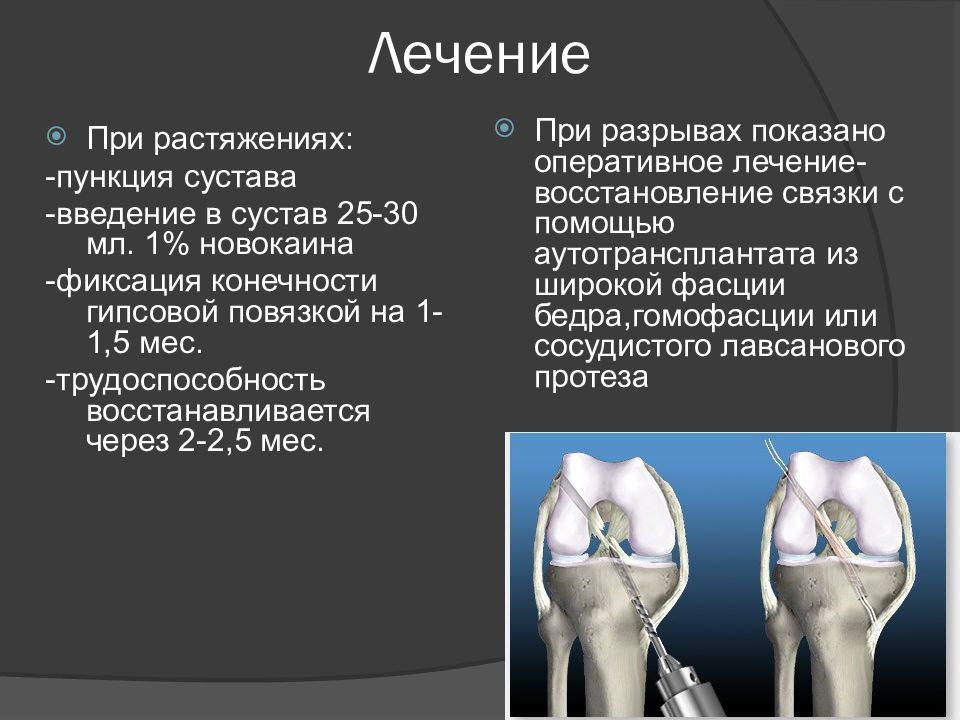 Повреждения и заболевания коленного сустава презентация