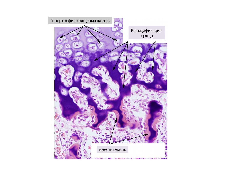Костная ткань гистология. Зона пузырчатого хряща гистология. Скелетные ткани хрящ гистология. Костные ткань прямой остеогенез функции гистология. Цитология клетка. Гистология ткани.