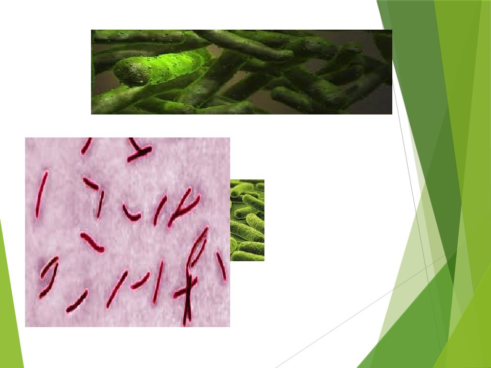 O'PKA OBSTRUKTIV YETISHMOVCHILIGI DIAGNOSTIKASI O'PKA OBSTRUKTIV YETISHMOVCHILIGI DIAGNOSTIKASI